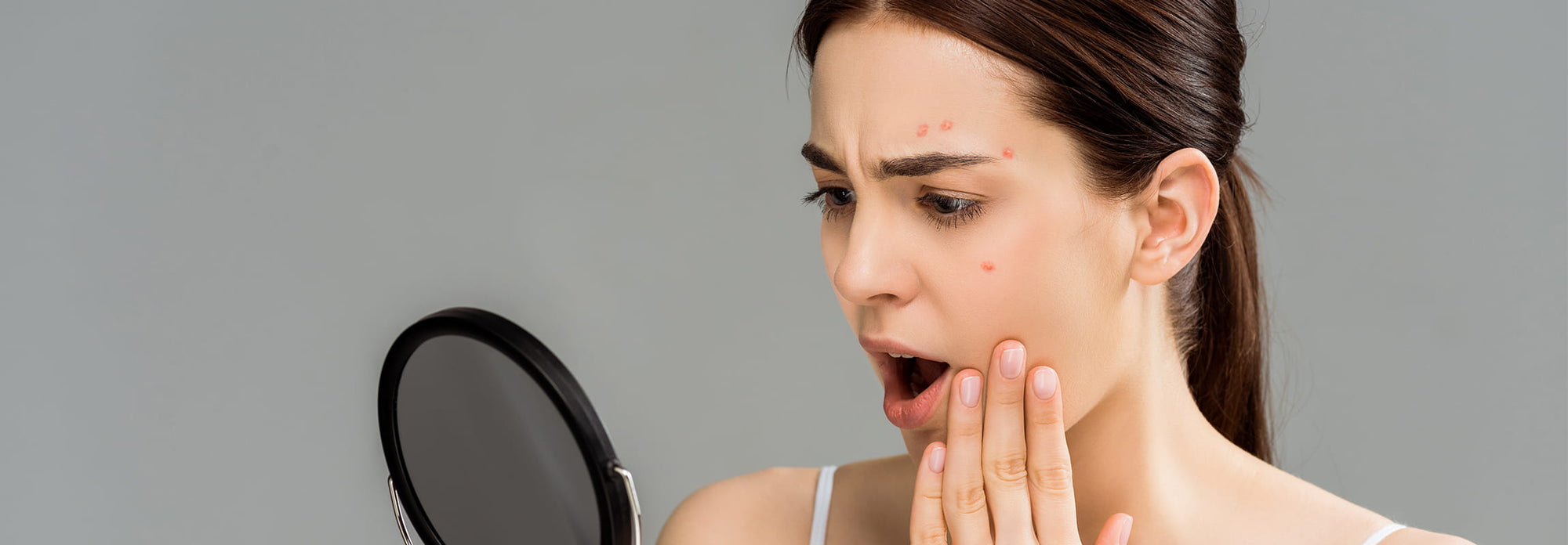 Acne & Diet: Which Foods to Eat and Which Foods to Avoid