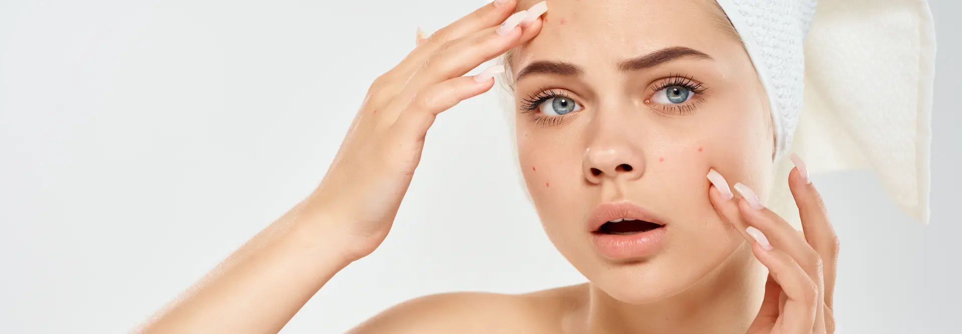 Best Timing and Treatment Practices for Dealing With Acne